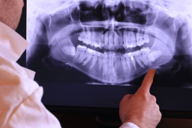 Best Walk-In Emergency Dentist in Terre Haute, IN